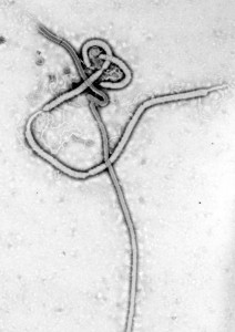 エボラウイルス　エボラ出血熱　感染経路　予防　症状　対策　日本